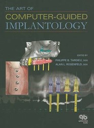 The Art of Computer-guided Implantology