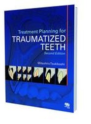 Treatment Planning for Traumatized Teeth