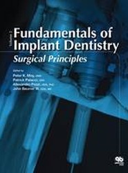 Fundamentals of Implant Dentistry