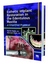 Esthetic Implant Restoration in the Edentulous Maxilla