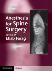 Anesthesia for Spine Surgery