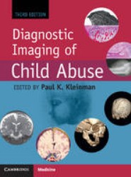 Diagnostic Imaging of Child Abuse