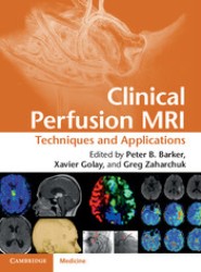 Clinical Perfusion MRI
