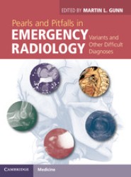 Pearls and Pitfalls in Emergency Radiology