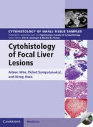 Cytohistology of Focal Liver Lesions