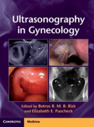Ultrasonography in Gynecology