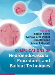 Complications of Neuroendovascular Procedures and Bailout Techniques