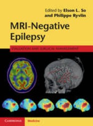 MRI-Negative Epilepsy