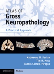 Atlas of Gross Neuropathology Book and Online Bundle
