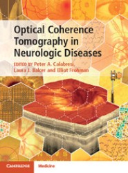 Optical Coherence Tomography in Neurologic Diseases