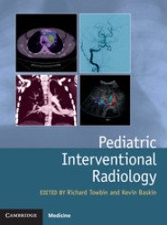 Pediatric Interventional Radiology