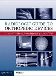 Radiologic Guide to Orthopedic Devices