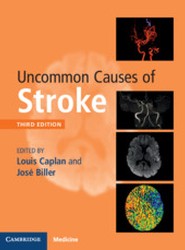Uncommon Causes of Stroke