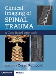Clinical Imaging of Spinal Trauma