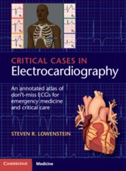 Critical Cases in Electrocardiography