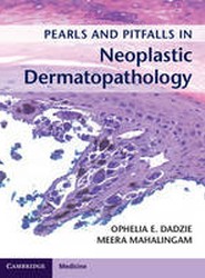 Pearls and Pitfalls in Neoplastic Dermatopathology with Online Access