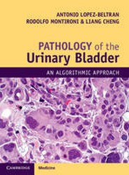 Pathology of the Urinary Bladder