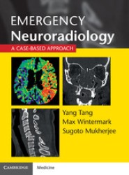 Emergency Neuroradiology