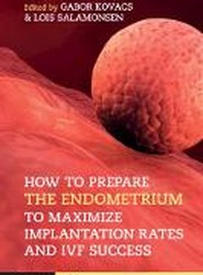 How to Prepare the Endometrium to Maximize Implantation Rates and IVF Success