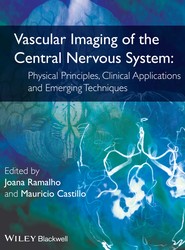 Vascular Imaging of the Central Nervous System - Physical Principles, Clinical Applications, and Emergency Techniques