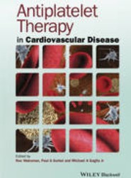 Antiplatelet Therapy in Cardiovascular Disease