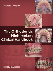 The Orthodontic Mini-implant Clinical Handbook
