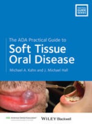 The ADA Practical Guide to Soft Tissue Oral Disease