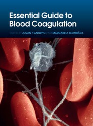 Essential Guide to Blood Coagulation