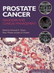 Prostate Cancer - Diagnosis and Clinical Management