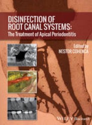 Disinfection of Root Canal Systems - The Treatment of Apical Periodontitis