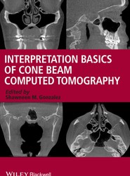 Interpretation Basics of Cone Beam Computed Tomography