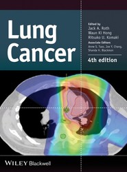 Lung Cancer 4e