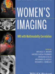Women's Imaging - MRI with Multimodality Correlation