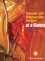 Vascular and Endovascular Surgery at a Glance