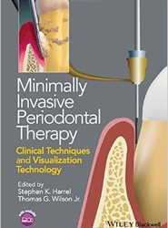 Minimally Invasive Periodontal Therapy - Clinical Techniques and Visualization Technology