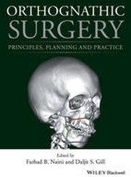 Orthognathic Surgery - Principles, Planning and Practice
