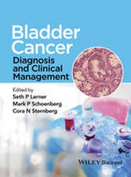 Bladder Cancer - Diagnosis and Clinical Management