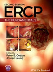 Ercp