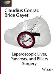 Laparoscopic Liver, Pancreas, and Biliary Surgery