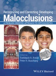 Recognizing and Correcting Developing Malocclusions - A Problem-Oriented Approach to Orthodontics