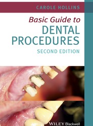Basic Guide to Dental Procedures 2e
