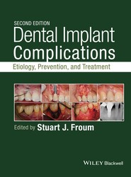 Dental Implant Complications - Etiology, , and Treatment, Second Edition