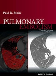 Pulmonary Embolism 3e