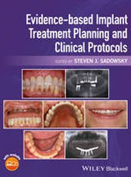 Evidence-based Implant Treatment Planning and Clinical Protocols