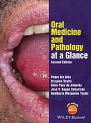 Oral Medicine and Pathology at a Glance 2e