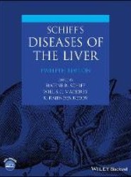 Schiff's Diseases of the Liver, 12th Edition