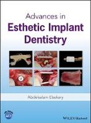 Advances in Esthetic Implant Dentistry