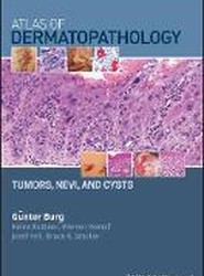 Atlas of Dermatopathology Tumors, Nevi, and Cysts