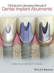 Clinical and Laboratory Manual of Dental Implant Abutments