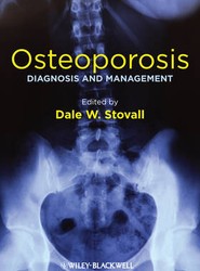 Osteoporosis - Diagnosis and Management
